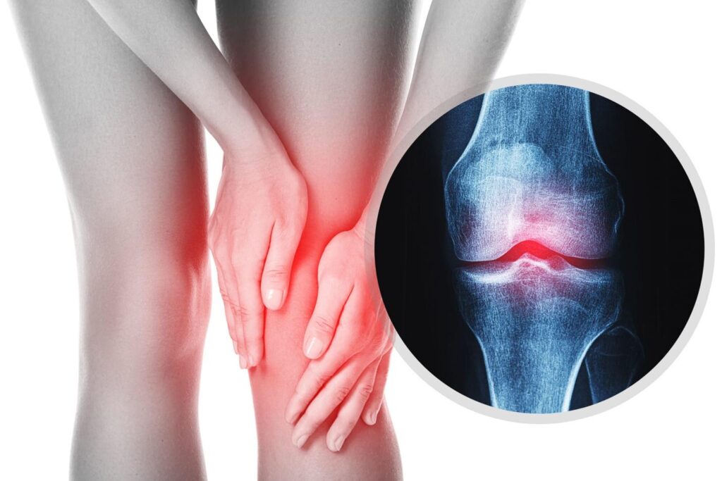 Chondroitin sulfát – účinky, dávkování a význam pro zdraví kloubů
