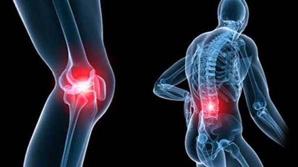Osteoporóza: Příznaky, příčiny, prevence a léčba | Kompletní průvodce